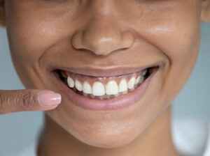 Lady Smiling After Gum Graft Treatment in Turkey